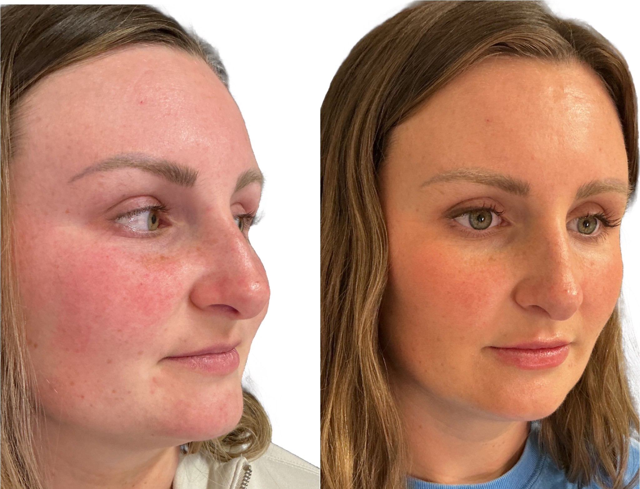 Aesthetic Results